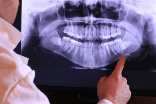 Best Emergency Dental Care for Sports Injuries in Hayfork, CA